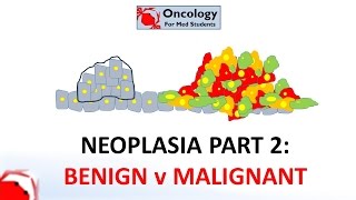 2 Neoplasia part 2 Differences between benign and malignant neoplasms [upl. by Emarie]