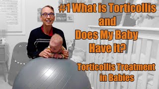 1 What is Torticollis and Does My Baby Have it Torticollis Treatment in Babies [upl. by Dnomhcir]