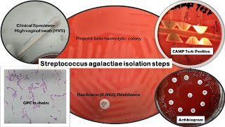 Streptococcus agalactiae Identification stepsGram stainBacitracin susceptibility CAMPAntibiogram [upl. by Grochow]