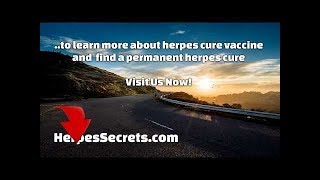 Herpes Cure Vaccine amp Research  Herpes 2018 News [upl. by Jorgensen]