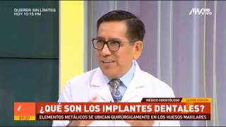 Implantes Dentales en 1 cita [upl. by Dranek988]