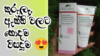 Acne Clear amp Skin Brightening Double Action Gel Review in sinhala [upl. by Dragon]