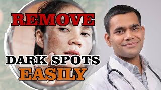 How To Get A CLEAR SKIN Naturally  Remove DARK SPOTS Fast  Dr Vivek Joshi [upl. by Larimer]