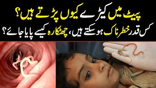 Pait kay Keeray  Stomach worms treatment in Urdu  پیٹ کے کیڑے ختم [upl. by Edgardo74]