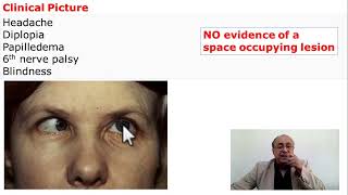 Pseudotumor Cerebri Benign increase of Intracranial Pressure [upl. by Peterman]