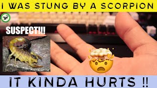 I WAS STUNG BY A SCORPION Hottentotta salei sting update [upl. by Joannes908]