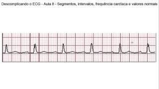 Descomplicando o ECG  Aula 8  Segmentos intervalos frequência cardíaca e valores normais [upl. by Mirak]