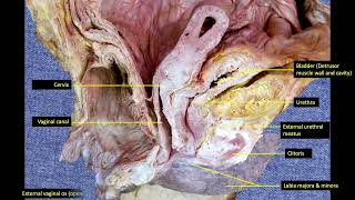 3Female pelvic organs 34 [upl. by Gustie676]