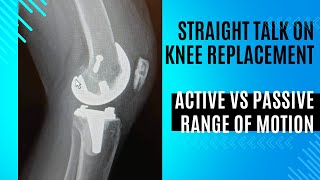 Straight Talk on Knee Replacement  Active vs Passive Range of Motion [upl. by Meakem]