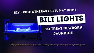 DIY Phototherapy Bili Lights setup at home to treat Newborn Jaundice [upl. by Adaminah]