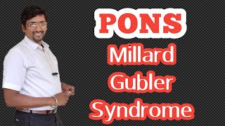 PONS  part 5 applied anatomy Millard Gubler syndrome [upl. by Neetsyrk920]