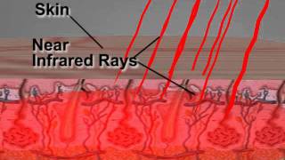 How Far Infrared Technology Works [upl. by Edgell]