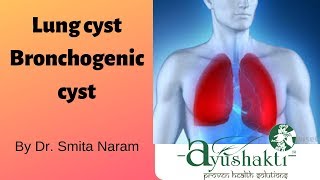 Lung cyst bronchogenic cystsmitanaram treatment with Ayushakti Ayurved [upl. by Suoivatco]