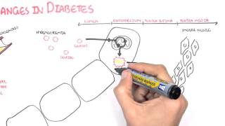 Diabetes Complication and Pathophysiology of the complication [upl. by Adiana870]