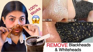 SKin PORES CLEANUP BLACKHEADS amp WHITEHEADS Remove at Home [upl. by Barbee]