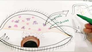 Trachoma  Stages Of Trachoma  Mac Callan Classification  clinical Features  conjunctivitis [upl. by Byers422]