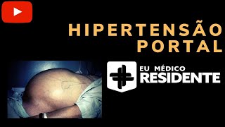 Hipertensão Portal para Residência Médica [upl. by Anirdnaxela]