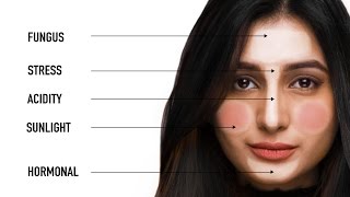 What Your Pimples Say About Your Health  Face Mapping with Dermatologist Bindu Sthalekar [upl. by Elwyn186]