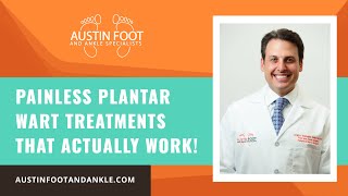 Painless Plantar Wart Treatments That Actually Work [upl. by Eivol315]