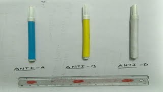 Determination of blood group [upl. by Creamer14]