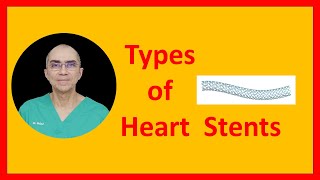 Types of Stents [upl. by Ttenyl]