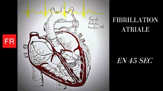 Arythmies animation cardiaque et ECG  Fibrillation Atriale Shorts [upl. by Ennaear]