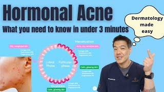 Hormonal acne explained in under 3 minutes  Dermatologist reviews [upl. by Odlabso633]