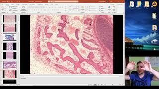 Histology of the Ossification part 1 [upl. by Westfahl]