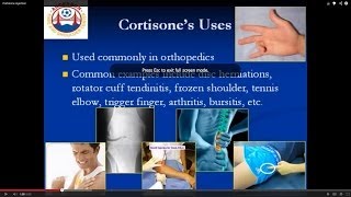 Your guide to cortisone injections [upl. by Genesa]