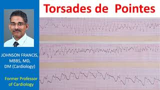 Torsades de Pointes [upl. by Hestia]