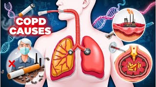 What causes COPD Top risk factors you should know [upl. by Piper]