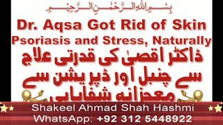 Dr Aqsa Cured Her Skin Psorasis Naturally  Qudrati Elaj se Skin Soriasis se Shifa  Urdu  Hindi [upl. by Jopa]