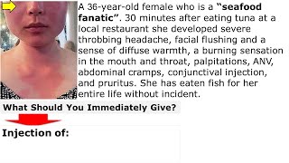 Reaction after eating fish What is your treatment Q CME internalmedicine محاضراتباطنة [upl. by Alisha]