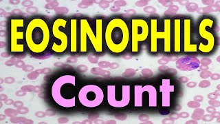 Eosinophils high in blood test means [upl. by Yrrah333]