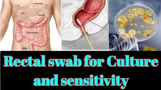 Rectal Swab for culture and sensitivity CS test UrduHindi [upl. by Aihseit]