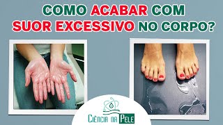 Como ACABAR Com O SUOR EXCESSIVO No Corpo  SAIBA COMO [upl. by Elery]