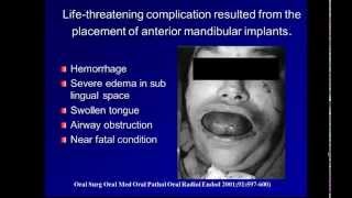 Complications in anterior implants [upl. by Arihsak]