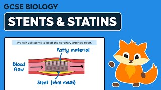 Stents amp Statins  GCSE Biology [upl. by Tichonn301]