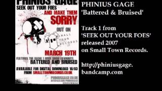 Phinius Gage  Battered amp Bruised [upl. by Ayekat]