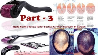 How Micro Needle Derma Roller System Work For Hair Regrowth Part 3 [upl. by Amor]