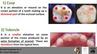 Dental Anatomy lec 3 Anatomical Landmarks with MCQs [upl. by Elleraj]