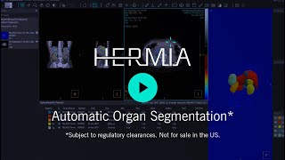 Automatic Organ Segmentation in Hermia Multimodality Viewer [upl. by Ettesyl]