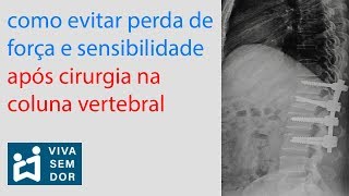 Como evitar perda de força e sensibilidade após cirurgia na coluna vertebral [upl. by Eseer]