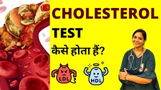 Cholesterol Test in Hindi  Cholesterol Test Kaise Kiya Jata Hai [upl. by Hubble151]