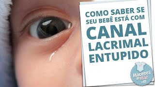 CANAL LACRIMAL ENTUPIDO E COMO TRATAR A OBSTRUÇÃO  MACETES DE MÃE [upl. by Joao772]