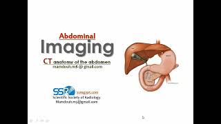 CT abdomen anatomy amp common lesions Prof Mamdouh Mahfouz [upl. by Fezoj]