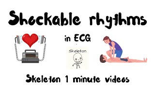 Shockable rhythms in ECG in 1 min  Skeleton ACLS shorts [upl. by Wiles]