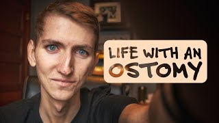 Living With An Ostomy [upl. by Aran892]