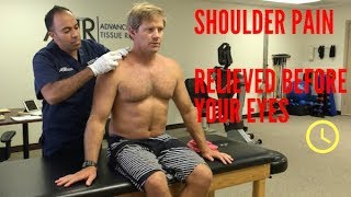 Unbelievable Chronic Shoulder Pain Relief REAL RESULTS [upl. by Jb]