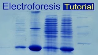 Electroforesis de proteínas tutorial Divulgación científica IQOGCSIC [upl. by Herrick]